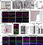 GST Tag Antibody in Immunohistochemistry (IHC)