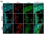 beta Catenin Antibody in Immunohistochemistry (IHC)