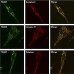 SDHA Antibody in Immunohistochemistry (IHC)