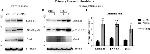 Phospho-STAT4 (Tyr693) Antibody in Western Blot (WB)