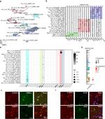 IL1RAPL2 Antibody in Immunohistochemistry (IHC)