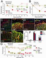 AANAT Antibody in Immunohistochemistry (IHC)