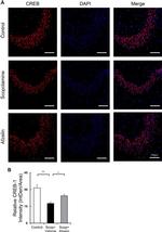 CREB Antibody in Immunohistochemistry, Immunohistochemistry (PFA fixed) (IHC, IHC (PFA))