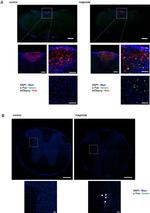 mCherry Antibody in Immunohistochemistry (IHC)