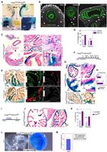 beta Galactosidase Antibody in Immunohistochemistry, Immunohistochemistry (Paraffin) (IHC, IHC (P))