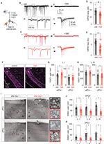 GABA Antibody in Immunohistochemistry (IHC)