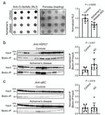 O-linked N-acetylglucosamine (O-GlcNAc) Antibody in Western Blot (WB)