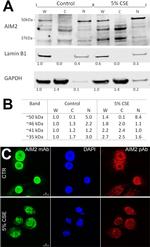 Lamin B1 Antibody in Western Blot (WB)