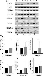 H3K27ac Antibody in Western Blot (WB)