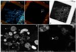 SARS/SARS-CoV-2 Coronavirus Spike Protein (subunit 1) Antibody in Immunohistochemistry (IHC)