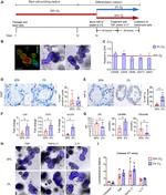 HIF1A Antibody in Immunohistochemistry, Immunohistochemistry (Paraffin) (IHC, IHC (P))