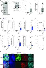Nkx2.1 Antibody in Immunocytochemistry (ICC/IF)