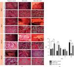 VEGF Antibody in Immunohistochemistry (IHC)