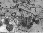 SARS-CoV-2 Spike Protein S1 Antibody in Immunohistochemistry (IHC)