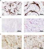 SARS/SARS-CoV-2 Nucleocapsid Antibody in Immunohistochemistry (IHC)