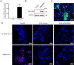 SARS/SARS-CoV-2 Nucleocapsid Antibody in Immunohistochemistry (IHC)