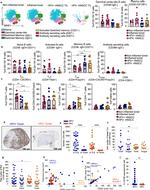 CD20 Antibody in Immunohistochemistry (IHC)