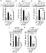 SREBP2 Antibody in Western Blot (WB)