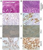 PD-1 Antibody in Immunohistochemistry (IHC)