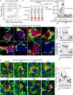 LC3B Antibody in Immunocytochemistry (ICC/IF)