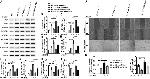 VCAM-1 (CD106) Antibody in Western Blot (WB)