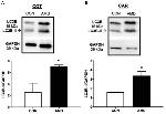 LC3B Antibody in Western Blot (WB)