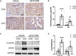 Phospho-STAT6 (Tyr641) Antibody in Immunohistochemistry (IHC)