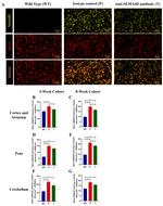 CD100 Antibody in Immunohistochemistry (IHC)