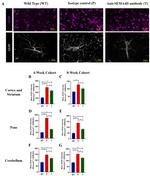 CD100 Antibody in Immunohistochemistry (IHC)