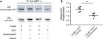 AMPK alpha-1,2 Antibody in Immunoprecipitation (IP)