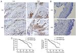 LAPTM4B Antibody in Immunohistochemistry (IHC)