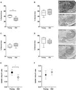 VGLUT1 Antibody in Immunohistochemistry (IHC)