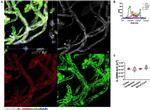 Aquaporin 4 Antibody in Immunocytochemistry (ICC/IF)