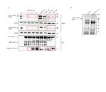 Cullin 1 Antibody in Immunoprecipitation (IP)