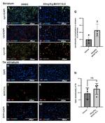 alpha Synuclein Antibody in Immunohistochemistry (IHC)