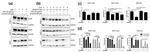 EGFR Antibody in Western Blot (WB)