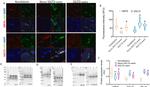 SGLT2 Antibody in Immunohistochemistry (IHC)