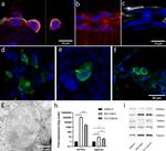 ABCA3 Antibody in Immunocytochemistry (ICC/IF)