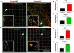 FosB Antibody in Immunocytochemistry (ICC/IF)