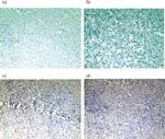 PAX3 Antibody in Immunohistochemistry (IHC)