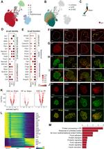 Insulin Antibody in Immunohistochemistry (IHC)