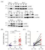 AGR2 Antibody in Western Blot (WB)