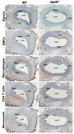 Alpha-Smooth Muscle Actin Antibody in Immunohistochemistry (IHC)