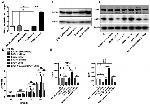 BACH1 Antibody in Western Blot (WB)