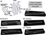 COPII Antibody in Immunohistochemistry (IHC)