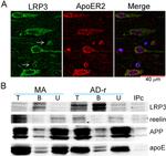 ApoER2 Antibody in Immunocytochemistry, Immunohistochemistry, Immunohistochemistry (Paraffin) (ICC/IF, IHC, IHC (P))