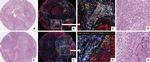 CD8 alpha Antibody in Immunohistochemistry (IHC)