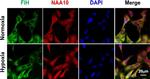 Rat IgG (H+L) Cross-Adsorbed Secondary Antibody in Immunocytochemistry (ICC/IF)
