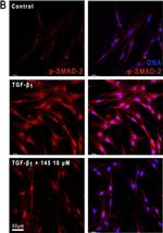 Rabbit IgG (H+L) Cross-Adsorbed Secondary Antibody in Immunocytochemistry (ICC/IF)