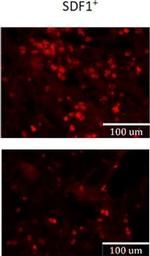 Rabbit IgG (H+L) Cross-Adsorbed Secondary Antibody in Immunocytochemistry (ICC/IF)